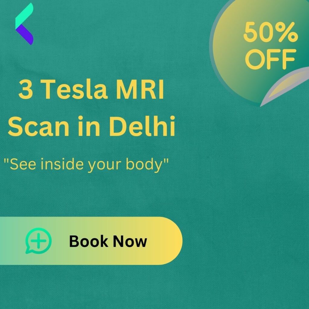 3T MRI in Delhi