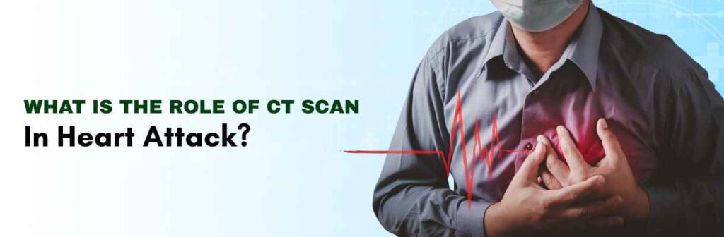 Role of CT Scan in Heart Attack