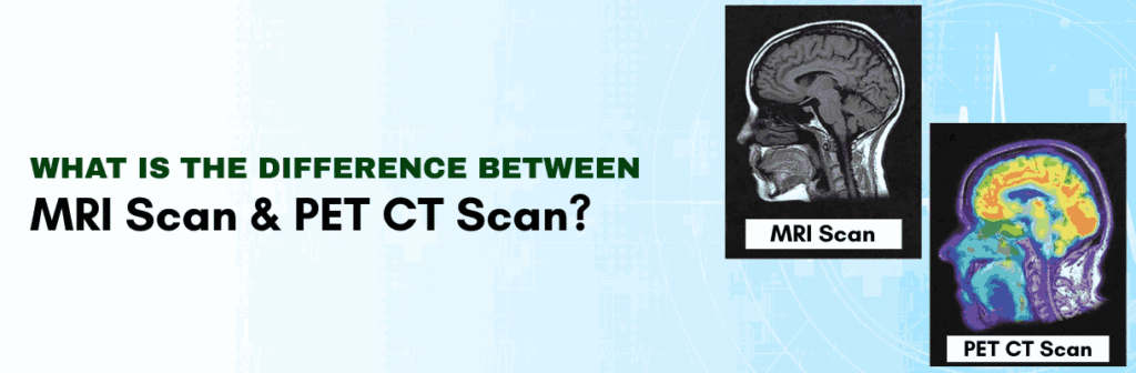 Difference Between MRI Scan and PET CT Scan