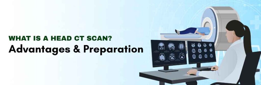 Head CT Scan
