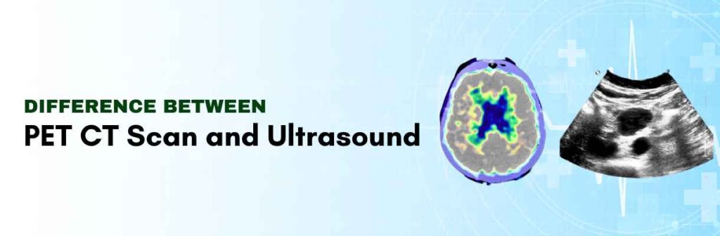PET CT Scan and Ultrasound